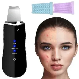 peeling-kawitacyjny-bezprzewodowy-ultradzwiekowy-5w1-twarzy-tradziku-blizn