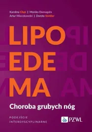 lipoedema-choroba-grubych-nog-praca-zbiorowa