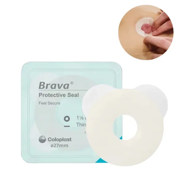 120370 Brava Ochronny Pierścień Uszczelniający Stomię 2,5 mm ø27 Coloplast