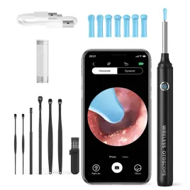 urzadzenie-do-czyszczenia-uszu-fotorob-otoskop-smart-stalowe-narzedzia