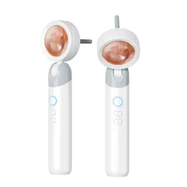 otoskop-kamera-czyszczenie-uszu-jamy-ustnej-skory-nosa-ekran-hd-zoom-4-led