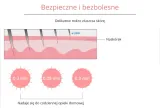 dermaroller-540-tytanowych-igiel-do-twarzy-i-ciala-mezoterapia-zloty-rodzaj-mezoterapii-mikroiglowa