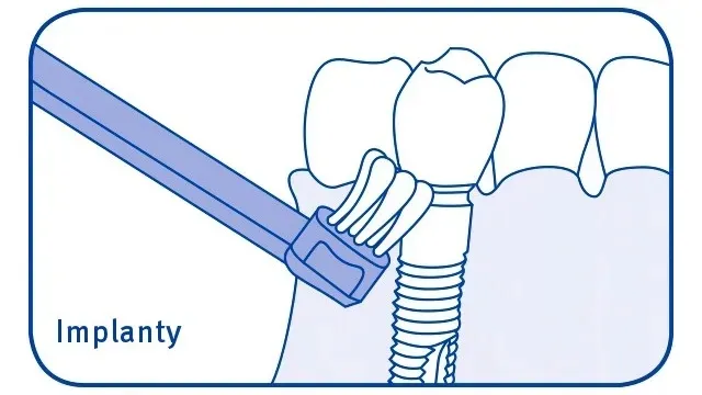 curaprox-cs-708-implant-and-ortho-twardosc-wlosia-miekkie