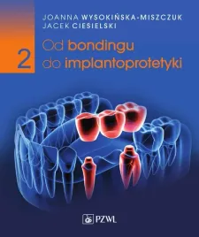 od-bondingu-do-implantoprotetyki-cz-2