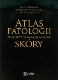 atlas-patologii-zlosliwych-nowotworow-skory