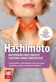 hashimoto-choroba-tarczycy-poradnik-ringier-axel-springer-polska-2021