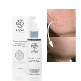 preparat-na-tradzik-przeciwtradzikowy-srebro-100ml