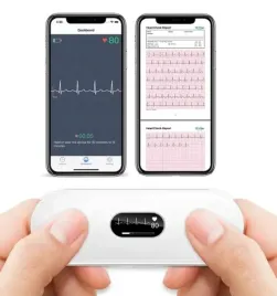 przenosny-monitor-ekg-er2-s-z-ekranem-pomiar-i-analiza-ai
