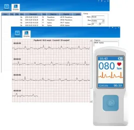 przenosny-monitor-aparat-holter-ekg-badanie-serca-arytmia-raport-pl