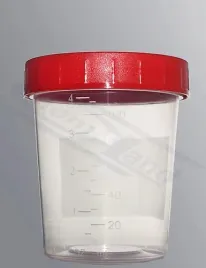pojemnik-na-mocz-z-nakretka-zakrecony-125ml-aseptyczny