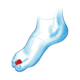 mazbit-ms465-oslona-na-palec-toe-tube-ms465-r-3