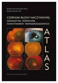 czerniak-blony-naczyniowej-diagnostyka