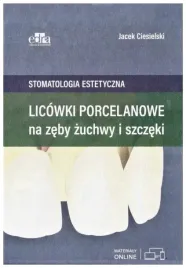 licowki-porcelanowe-na-zeby-zuchwy-i-szczeki
