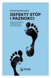 defekty-stop-i-paznokci-praktyczny-poradnik