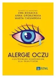 alergie-oczu-ilustrowane-kompendium-dla-praktykow