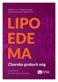 lipoedema-artur-mieczkowski