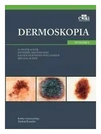 dermoskopia-soyer-h-p