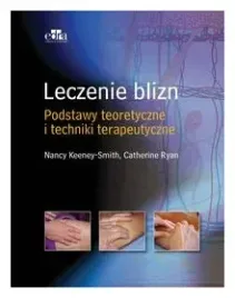 leczenie-blizn-pourazowych