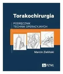 torakochirurgia-marcin-zielinski
