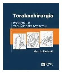 torakochirurgia-marcin-zielinski