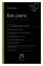 rak-piersi-agnieszka-jagiello-gruszfeld