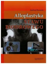 alloplastyka-stawu-biodrowego