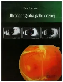 fryczkowski-ultrasonografia-galki-ocznej