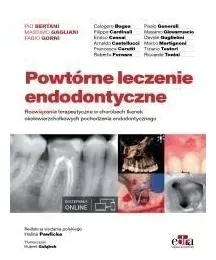 powtorne-leczenie-endodontyczne