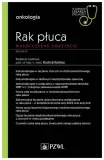 rak-pluca-wspolczesne-podejscie