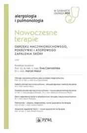 nowoczesne-terapie-obrzeku-naczynioruchowego