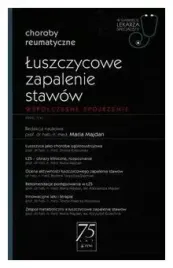 luszczycowe-zapalenie-stawow-maria-majdan
