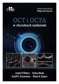 oct-i-octa-w-chorobach-siatkowki-j-p-ehlers