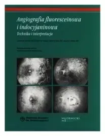 berkow-angiografia-fluoresceinowa-i-indocyjaninowa