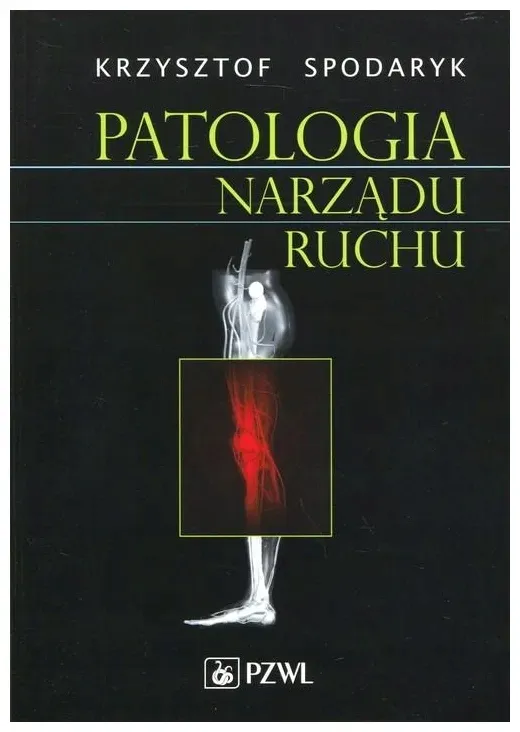 spodaryk-patologia-narzadu-ruchu
