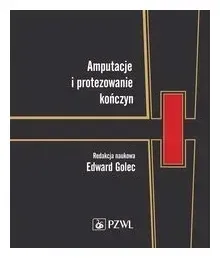 amputacje-i-protezowanie-konczyn