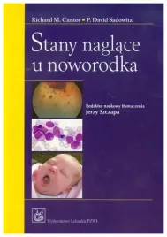 cantor-stany-naglace-u-noworodka