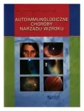 kanski-autoimmunologiczne-choroby-narzadu-wzroku