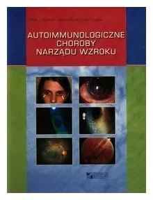 kanski-autoimmunologiczne-choroby-narzadu-wzroku