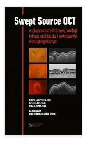 romanowska-dixon-swept-source-oct-w-diagnostyce