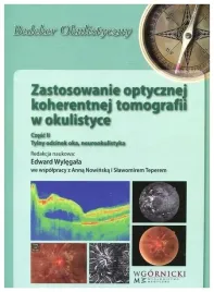zastosowanie-optycznej-koherentnej-tomografii-w