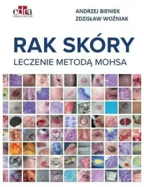 rak-skory-leczenie-metoda-mohsa-andrzej-bieniek