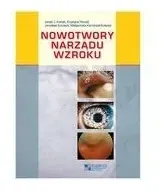 nowotwory-narzadu-wzroku
