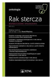 rak-stercza-wspolczesne-spojrzenie
