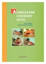 alergiczne-choroby-oczu-czajkowski-janusz