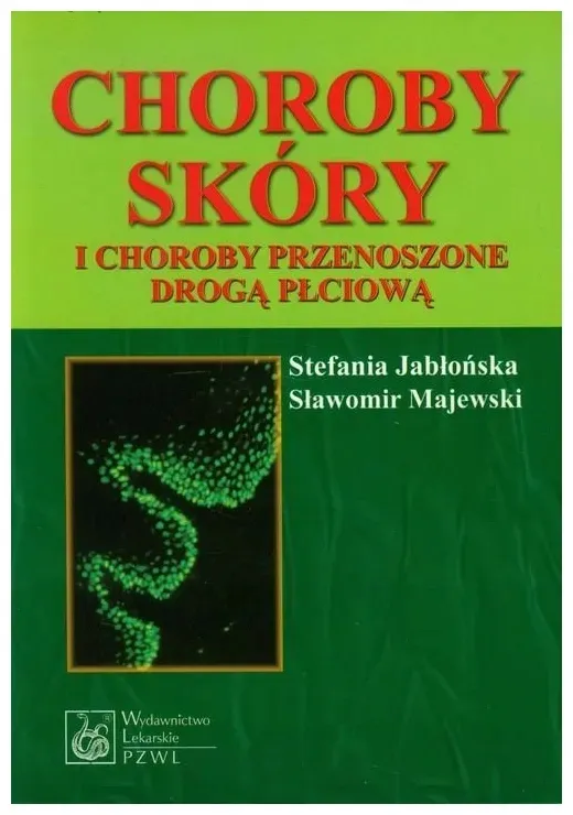 jablonska-choroby-skory-i-choroby-przenoszone