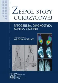 zespol-stopy-cukrzycowej-praca-zbiorowa