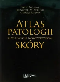 atlas-patologii-zlosliwych-nowotworow-skory-andrzej-kaszuba-krzysztof-w-zielinski-leszek-wozniak