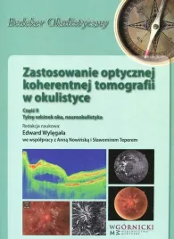 zastosowanie-optycznej-koherentnej-tomografii-w-okulistyce-czesc-2-praca-zbiorowa