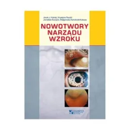 nowotwory-narzadu-wzroku-praca-zbiorowa