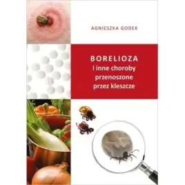 borelioza-i-inne-choroby-przenoszone-przez-kleszcze